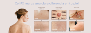 Dermomedic - Dile adios a las imperfecciones de tu piel con Cell FX