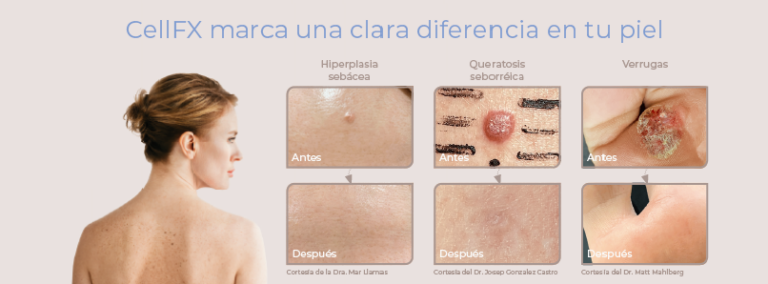Dermomedic - Dile adios a las imperfecciones de tu piel con Cell FX