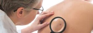 Dermomedic - Cáncer de piel: qué es