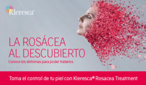 Dermomedic - Kleresca® Rosacea Treatment: la solución a tu problema