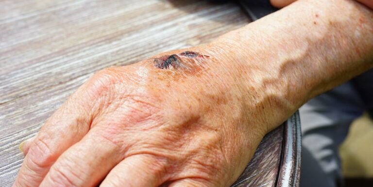 Dermomedic - Las patologías más frecuentes en dermatología: Avances y novedades