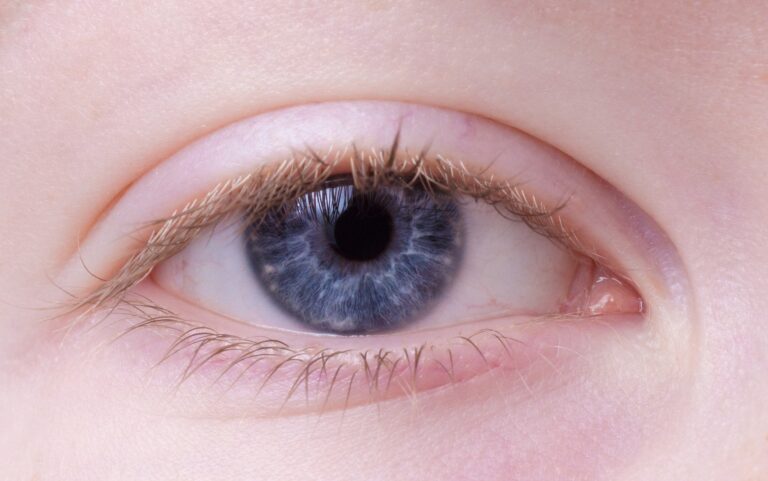 Dermomedic - Blefaroplastia o cirugía de párpados y ojeras