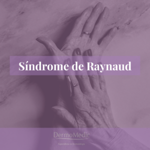 Dermomedic - Síndrome de Raynaud