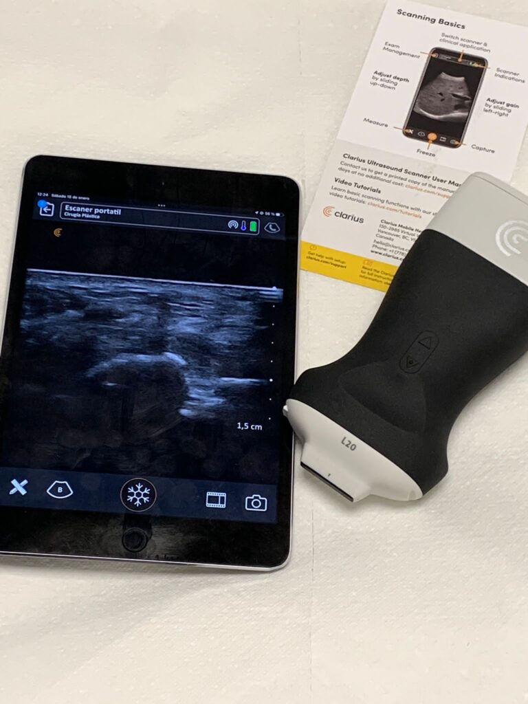 Dermomedic - Nuevo scanner de ultrasonidos en Dermomedic