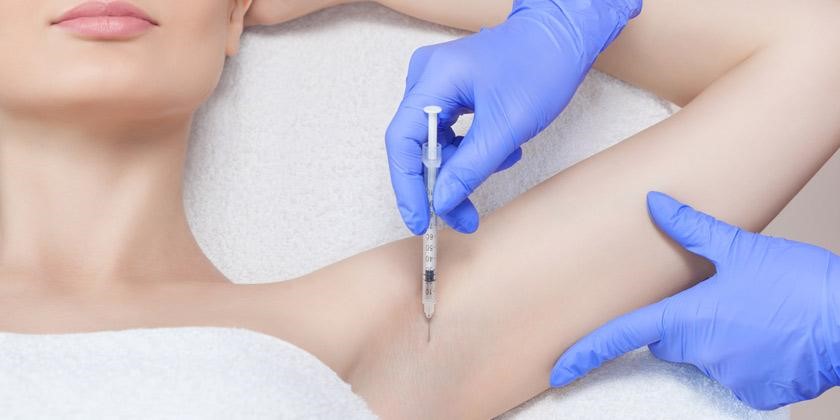 Toxina botulínica (bótox) para la hiperhidrosis