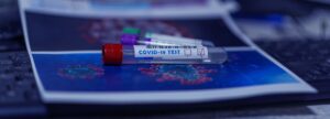 Dermomedic - ¿Cuál es el mejor test para saber el estado de inmunidad ante el COVID 19?