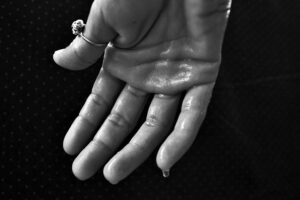 Dermomedic - ¿Te sudan las manos en exceso?