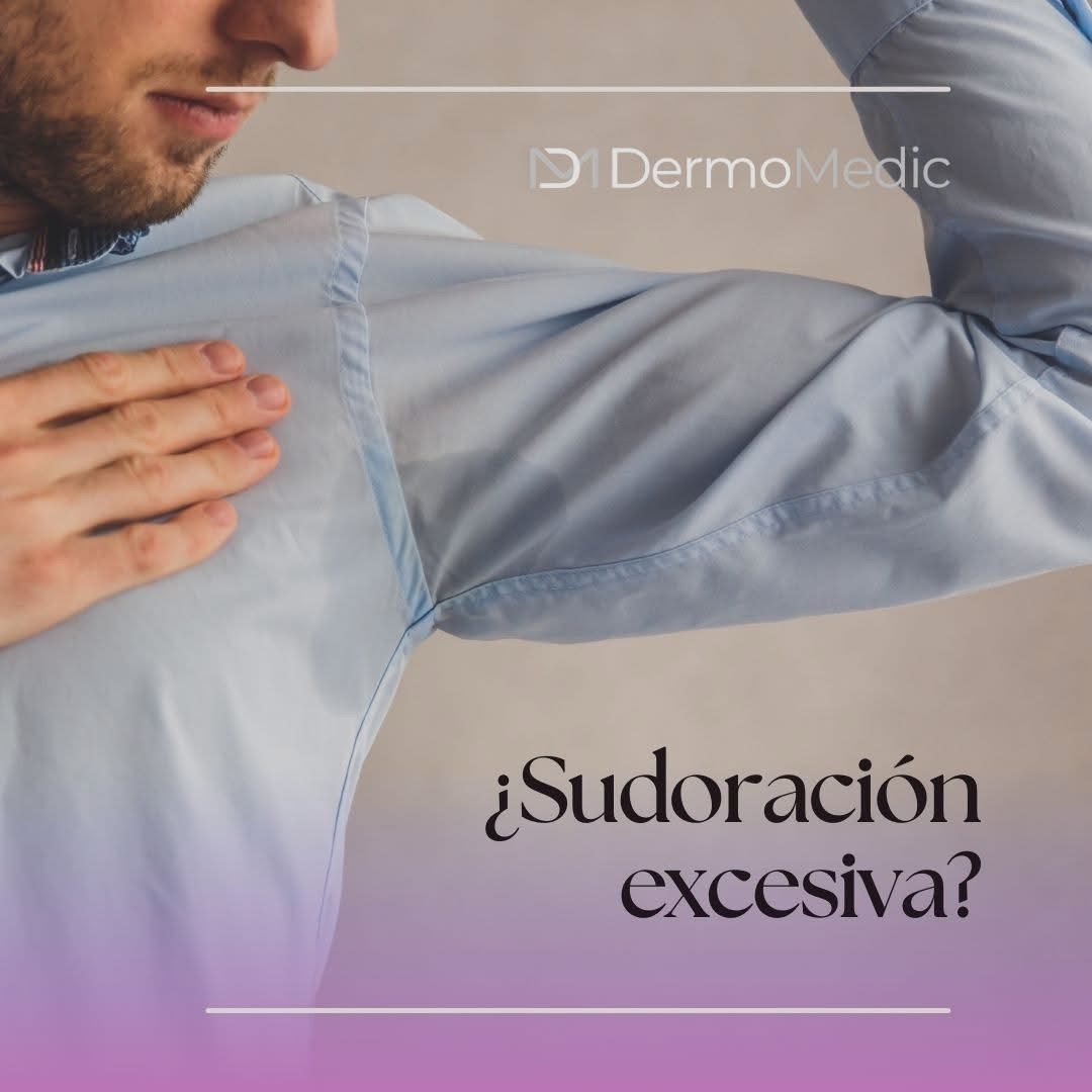 Soluciones y tratamientos para la hiperhidrosis en Dermomedic