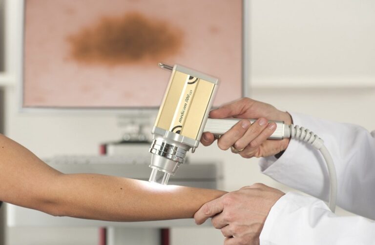 Dermatólogo realizando una dermatoscopia digital en el brazo de un paciente